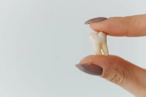 paciente revisando una fractura dental en clínica